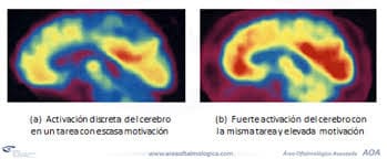 neurofeedback